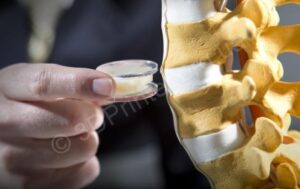 Приклади використання 3D-друку в медицині